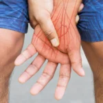 L’hypnose pour les douleurs neuropathiques 